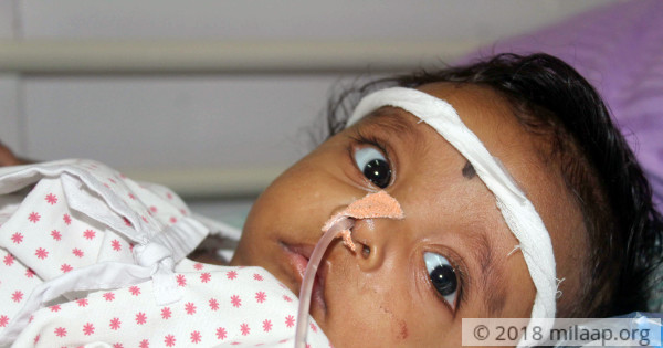 5-Month-Old Chokes Every Time He Cries Because Of Cancerous Tumour | Milaap